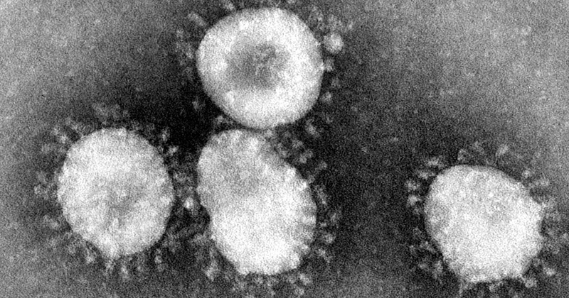 Imagem microscópica do coronavírus. O nome foi atribuído a sua aparência de coroa. Foto: Wikimedia Commons